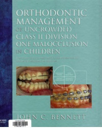Orthodontic Management Of Uncrowded Class II Division One Malocclusion In Children