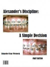 Alexander’s Discipline: A Simple Decision