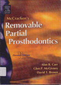 Mc Crackens Removable Partial  Prosthodontics