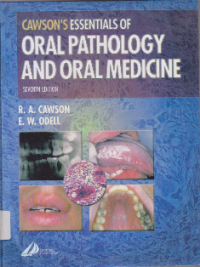 Cawsons Essentials of Oral Pathology And Oral Medicine