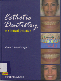 ESTHETIC DENTISTRY IN CLINICAL PRACTICE