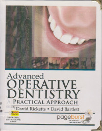 ADVANCED OPERATIVE DENTISTRY PRACTICAL APPROACH