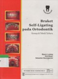 Image of Braket Self-Ligating Pada Ortodontik : Konsep & Teknik Terbaru