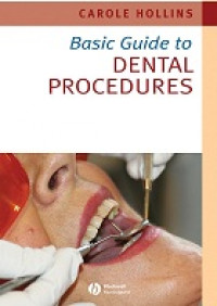 Image of Basic Guide To Dental Procedures