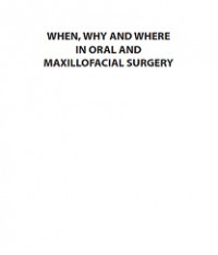 WHEN, WHY AND WHERE IN ORAL AND MAXILLOFACIAL SURGERY
