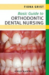 Basic guide To Orthodontic Dental Nursing