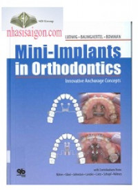 Mini - Implants In Orthodontics Innovative Anchorage Concepts