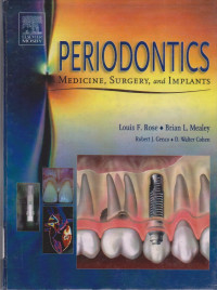 Image of Periodontics Medicine,Surgery,and Implants