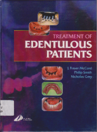 Treatment Of  Edentulous  Patients
