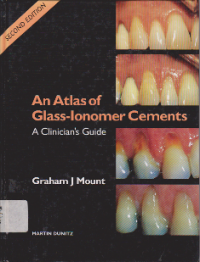 Clinical Techniques in Dentistry  An Atlas of Glass-Ionomer  Cements A Clinician Guide