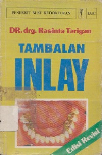 Tambalan Inlay