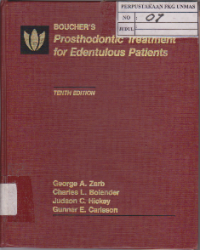 Bouchers Prosthodontic Treatment for Edentulous Patients