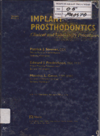 Implant Prosthodontics  Clinical and Laboratory Procedures