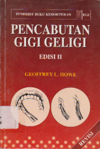 Pencabutan Gigi Geligi (The Extraction of Teeth)