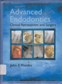 Advanced Endodontics Clinical Retreatment and Surgery