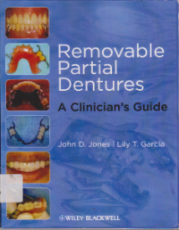 Removable Partial dentures ; A Clinicians Guide