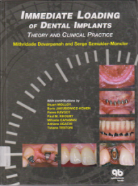 Immediate Loading of Dental Implants Theory and Clinical Practice