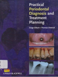 Image of PRACTICAL PERIODONTAL DIAGNOSIS AND TREATMENT PLANNING