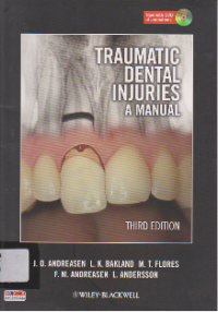 Traumatic Dental Injuries: A manual