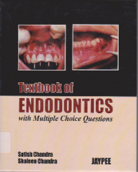 TEXTBOOK OF ENDODONTICS WITH MULTIPLE CHOICE QUESTIONS