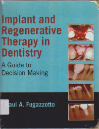 IMPLANT AND REGENERATIVE THERAPY IN DENTISTRY