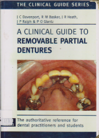 A CLINICAL GUIDE TO REMOVABLE PARTIAL DENTURES
