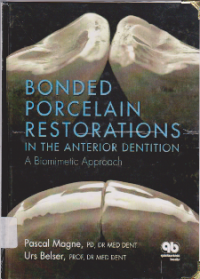 Bonded Porcelain Restorations in the Anterior Dentition: A Biomimetic Approach