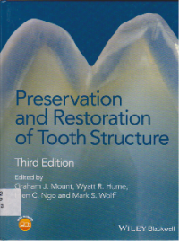 Preservation and Restoration of Tooth Structure
