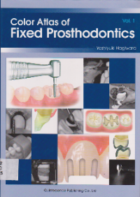 Color Atlas of Fixed Prosthodontics