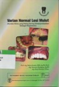 Varian Normal Lesi mulut : Kondisi Klisis Yang Paling Sering Diinterpretasikan Sebagai Keganasan