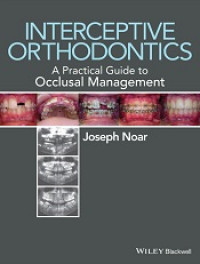 Image of Interceptive Orthodontics A Practical Guide to Occlusal Management