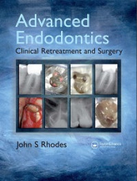 Image of Advanced Endodontics
