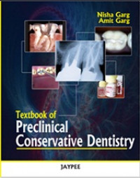 Textbook of Preclinical Conservative Dentistry