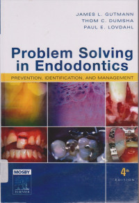Image of Problem  Solving in  Endodontics Prevention, Indentification, and Management
