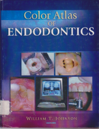 Color Atlas of Endodontics