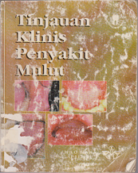 Image of Tijauan Klinis Penyakit Mulut