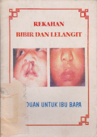 Image of Rekahan Bibir dan Lelangit: Panduan untuk Ibu Bapa