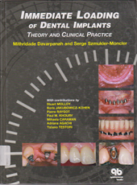 Image of Immediate Loading of Dental Implants Theory and Clinical Practice