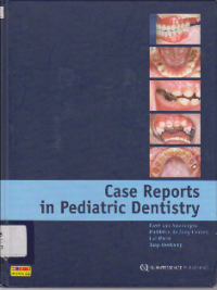 Image of Case Reports in Pediatric Dentistry