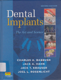 DENTAL IMPLANTS THE ART AND SCIENCE