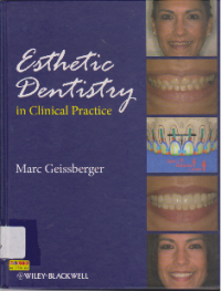 Image of ESTHETIC DENTISTRY IN CLINICAL PRACTICE