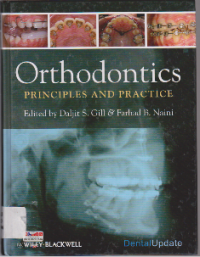 Image of ORTHODONTICS PRINCIPLES AND PRACTICE