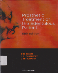 Prosthetic Treatment of the Edentulous Patient