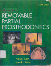 Image of REMOVABLE PARTIAL PROSTHODONTICS