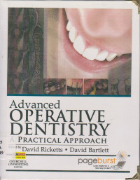 Image of ADVANCED OPERATIVE DENTISTRY PRACTICAL APPROACH