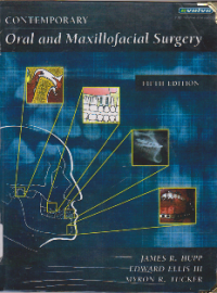 Image of CONTEMPORARY ORAL AND MAXILLOFACIAL SURGERY