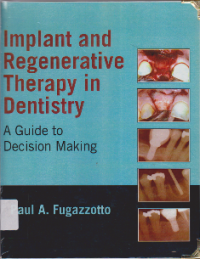 Image of IMPLANT AND REGENERATIVE THERAPY IN DENTISTRY