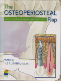 Image of THE OSTEOPERIOSTEAL FLAP
