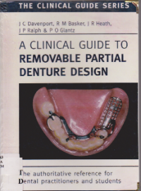 Image of A CLINICAL GUIDE TO REMOVABLE PARTIAL DENTURES DESIGN