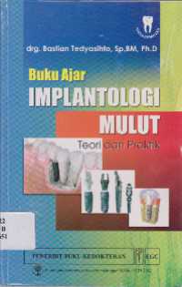 BUKU AJAR IMPLANTOLOGI MULUT TEORI DAN PRAKTEK